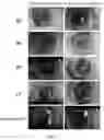 Fig. 04 - COMPOSITION OF LANOSTEROL PRODRUG COMPOUND, PREPARATION METHOD THEREFOR AND USE THEREOF