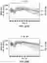 Fig. 33 - COMPOSITIONS OF OBETICHOLIC ACID AND METHODS OF USE