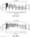 Fig. 44 - COMPOSITIONS OF OBETICHOLIC ACID AND METHODS OF USE