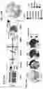 Fig. 28 - ESTROGEN RECEPTOR INHIBITORS AND USES THEROF