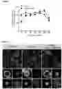 Fig. 04 - COMPOSITIONS AND METHODS USEFUL FOR TREATING DISEASES CHARACTERIZED BY INSUFFICIENT PANTOTHENATE KINASE ACTIVITY