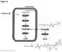 Fig. 23 - COMPOSITIONS AND METHODS USEFUL FOR TREATING DISEASES CHARACTERIZED BY INSUFFICIENT PANTOTHENATE KINASE ACTIVITY