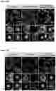 Fig. 31 - COMPOSITIONS AND METHODS USEFUL FOR TREATING DISEASES CHARACTERIZED BY INSUFFICIENT PANTOTHENATE KINASE ACTIVITY