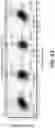 Fig. 06 - Identification and treatment of T-cell epitopes of short H2A oncohistones