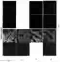 Fig. 12 - Compositions and Methods for Treating or Preventing Gut Permeability-Related Disorders