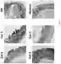 Fig. 18 - Compositions and Methods for Treating or Preventing Gut Permeability-Related Disorders