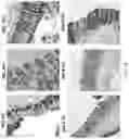 Fig. 19 - Compositions and Methods for Treating or Preventing Gut Permeability-Related Disorders