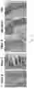 Fig. 20 - Compositions and Methods for Treating or Preventing Gut Permeability-Related Disorders