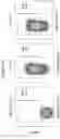 Fig. 07 - Restimulation of cryopreserved tumor infiltrating lymphocytes