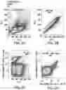 Fig. 03 - Method and system for isolation of mesenchymal stem cell exosomes