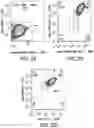 Fig. 04 - Method and system for isolation of mesenchymal stem cell exosomes