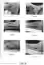 Fig. 06 - COMPOSITIONS DERIVED FROM HUMAN AMNION CELLS & RELATED METHODS