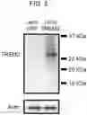 Fig. 04 - COMPOSITIONS AND METHODS FOR TREATING NEUROCOGNITIVE DISORDERS