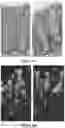 Fig. 09 - METHOD AND COMPOSITION FOR TREATING GASTROINTESTINAL INFLAMMATORY DISORDERS