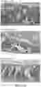 Fig. 16 - METHOD AND COMPOSITION FOR TREATING GASTROINTESTINAL INFLAMMATORY DISORDERS