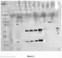 Fig. 11 - A MODIFIED ONCOLYTIC VIRUS, COMPOSITION AND USE THEREOF