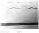 Fig. 13 - A MODIFIED ONCOLYTIC VIRUS, COMPOSITION AND USE THEREOF