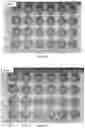 Fig. 25 - A MODIFIED ONCOLYTIC VIRUS, COMPOSITION AND USE THEREOF