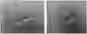 Fig. 01 - Compositions and methods for treating and removing seborrheic keratoses
