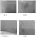 Fig. 03 - Compositions and methods for treating and removing seborrheic keratoses