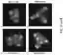 Fig. 10 - METHODS AND COMPOSITIONS FOR RESTORING STMN2 LEVELS