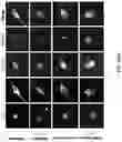 Fig. 136 - METHODS AND COMPOSITIONS FOR RESTORING STMN2 LEVELS