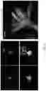 Fig. 16 - METHODS AND COMPOSITIONS FOR RESTORING STMN2 LEVELS