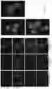 Fig. 24 - METHODS AND COMPOSITIONS FOR RESTORING STMN2 LEVELS