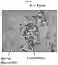 Fig. 06 - Compositions for treating pathological calcification conditions, and methods using same