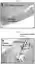 Fig. 15 - Compositions for treating pathological calcification conditions, and methods using same