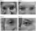 Fig. 02 - HYALURONIDASE COMPOSITIONS AND METHODS OF USING SAME TO TREAT EDEMA