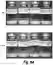 Fig. 13 - Methods and compositions for CNS delivery of heparan N-sulfatase