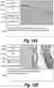 Fig. 18 - Methods and compositions for CNS delivery of heparan N-sulfatase