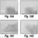 Fig. 25 - Methods and compositions for CNS delivery of heparan N-sulfatase