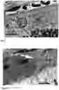Fig. 06 - Method for the Treatment of a Disease Using Pigment Epithelium-Derived Factor (PEDF)