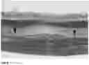 Fig. 08 - Method for the Treatment of a Disease Using Pigment Epithelium-Derived Factor (PEDF)