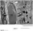 Fig. 12 - Method for the Treatment of a Disease Using Pigment Epithelium-Derived Factor (PEDF)
