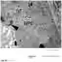 Fig. 13 - Method for the Treatment of a Disease Using Pigment Epithelium-Derived Factor (PEDF)