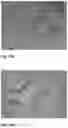 Fig. 17 - Method for the Treatment of a Disease Using Pigment Epithelium-Derived Factor (PEDF)