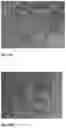 Fig. 18 - Method for the Treatment of a Disease Using Pigment Epithelium-Derived Factor (PEDF)