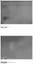 Fig. 20 - Method for the Treatment of a Disease Using Pigment Epithelium-Derived Factor (PEDF)