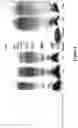 Fig. 06 - Derivatisation of Insulin with Polysaccharides