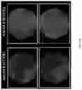 Fig. 08 - HIGHLY EFFICIENT TRANSDUCTION AND LATERAL SPREAD IN THE RETINA BY A NOVEL AAV VIRUS ENHANCED BY RATIONAL DESIGN