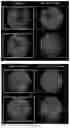 Fig. 15 - HIGHLY EFFICIENT TRANSDUCTION AND LATERAL SPREAD IN THE RETINA BY A NOVEL AAV VIRUS ENHANCED BY RATIONAL DESIGN