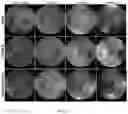Fig. 25 - HIGHLY EFFICIENT TRANSDUCTION AND LATERAL SPREAD IN THE RETINA BY A NOVEL AAV VIRUS ENHANCED BY RATIONAL DESIGN