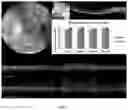 Fig. 27 - HIGHLY EFFICIENT TRANSDUCTION AND LATERAL SPREAD IN THE RETINA BY A NOVEL AAV VIRUS ENHANCED BY RATIONAL DESIGN