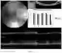 Fig. 29 - HIGHLY EFFICIENT TRANSDUCTION AND LATERAL SPREAD IN THE RETINA BY A NOVEL AAV VIRUS ENHANCED BY RATIONAL DESIGN