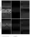 Fig. 32 - HIGHLY EFFICIENT TRANSDUCTION AND LATERAL SPREAD IN THE RETINA BY A NOVEL AAV VIRUS ENHANCED BY RATIONAL DESIGN