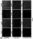 Fig. 22 - Gene Therapy