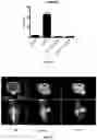 Fig. 05 - Small Molecules for Dual Function Positron Emission Tomography (PET) and Cell Suicide Switches